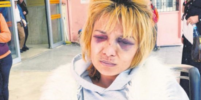 'Bulaşık' yüzünden eşini hastanelik eden şahıs tutuklandı