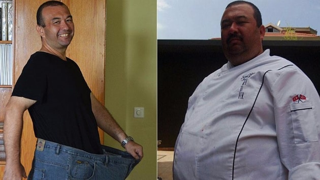 Obezite cerrahisinin ardından 65 kilo verip yeni bir hayata başladı