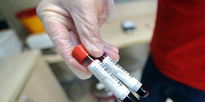 Kanserle mücadelenin yeni silahı: kan testleri