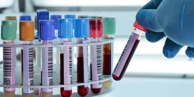 Tek kan testiyle 20 kanser türü tespit edilebiliyor