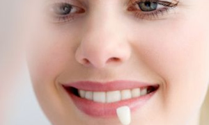 Sağlıklı dişler için 8 öneri