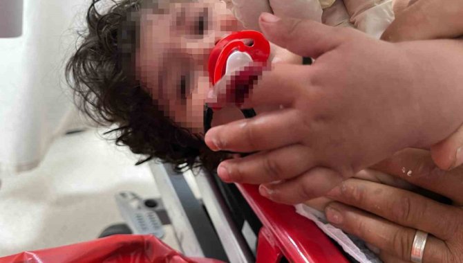 1 Yaşındaki Bebek Parmağını Vantilatöre Kaptırdı, Uzmanlar Uyardı: “1 Ayda 4-5 Hastamız Oldu”
