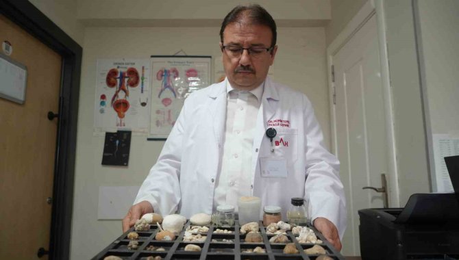 Hastaların Çilesi Olan ’Taşlar’ Üroloji Uzmanına Koleksiyon Oldu