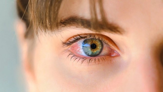 Göz Uzmanından Uyarı: “Yaz Güneşi Tehlikeli Göz Hastalıklarına Kapı Aralıyor””