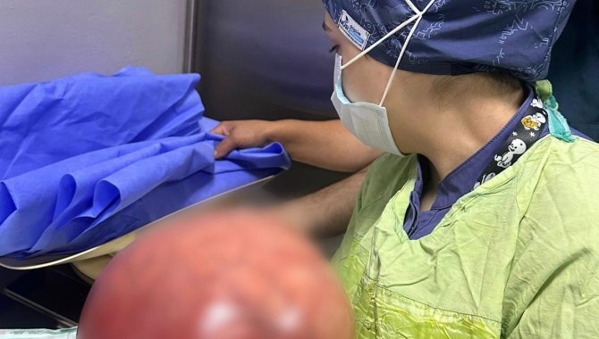 Hastaneye Karın Ağrısı Şikayeti İle Gelen Hastanın Rahminden 5,5 Kilogramlık Kitle Çıktı