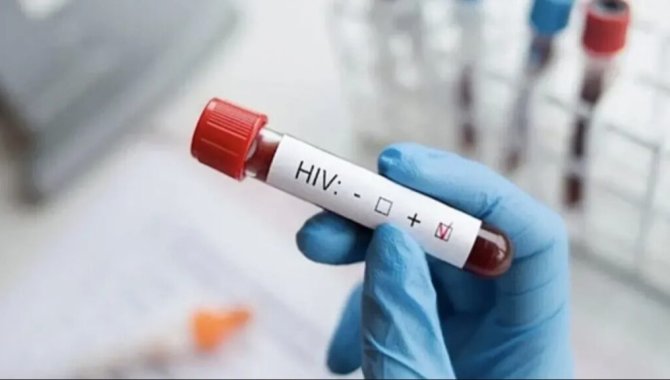 Türk Kızılay'dan kan bağışı ve HIV iddialarına ilişkin açıklama: