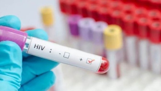 HIV/AIDS'e yönelik Gönüllü Test Merkezlerinin sayısı 10'a ulaşıyor