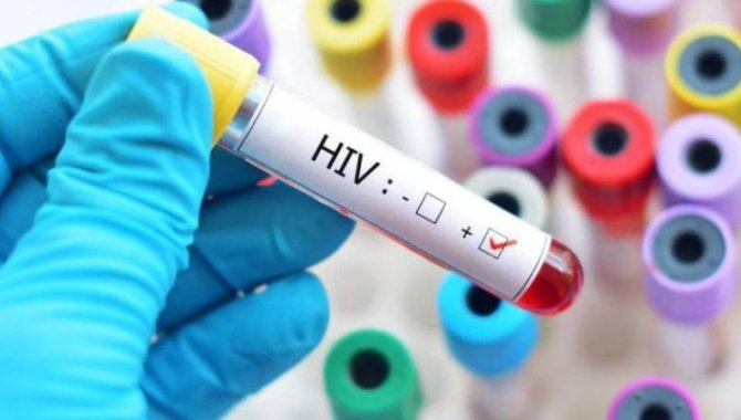 Nijerya'da her yıl yaklaşık 42 bin 700 kişi AIDS nedeniyle hayatını kaybediyor