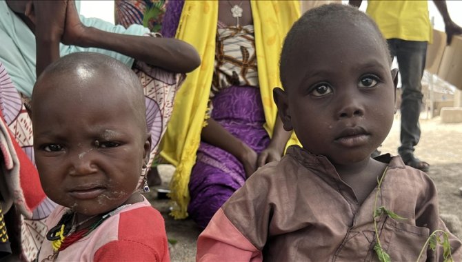 Güney Afrika'da bu yıl 600'den fazla çocuk yetersiz beslenme nedeniyle öldü