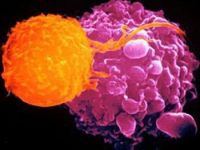 Pankreas kanseri için kimler risk altında?