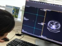 Altınbaş Üniversitesi akciğer kanserinde erken tanı için yapay zekadan faydalanacak