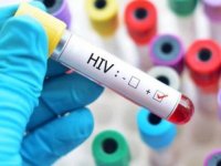 Nijerya'da her yıl yaklaşık 42 bin 700 kişi AIDS nedeniyle hayatını kaybediyor