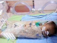 'Öldü' diye anne karnından alınan bebek, 109 günde yeniden hayata tutundu