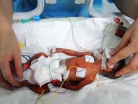 Anne karnındaki bebeğe 8 operasyon